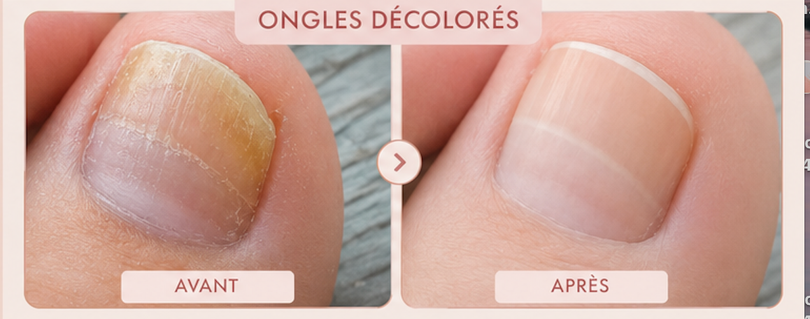 Stylo Soin des Pieds – Triple Action | Vélya